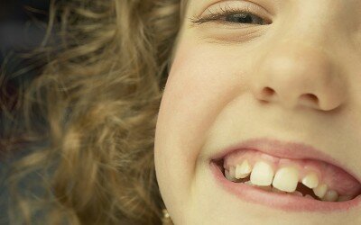 Super Smiles: Keep Kids’ Teeth Gleaming