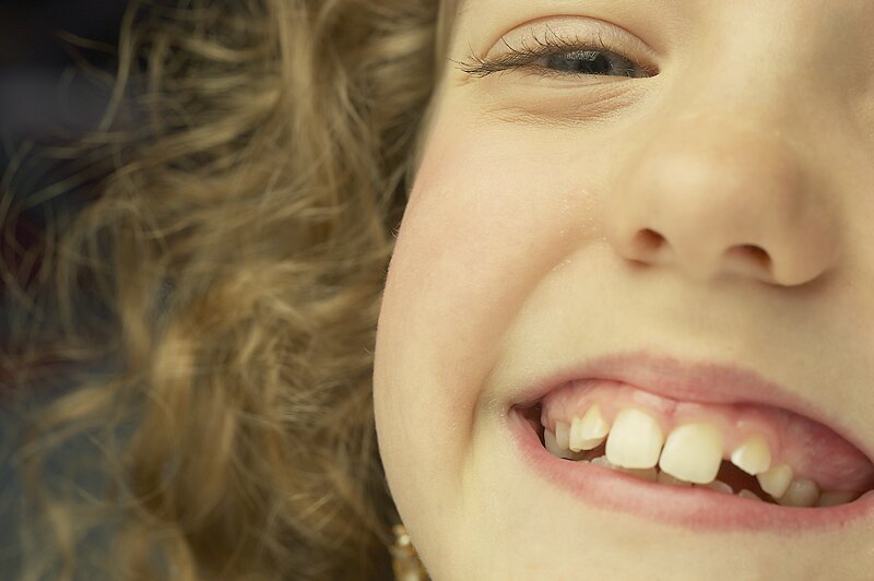 Super Smiles: Keep Kids’ Teeth Gleaming